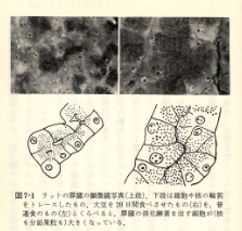 糖尿病を予防しよう!!のアイキャッチ画像